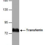 ANTI-TRANSFERRIN EA